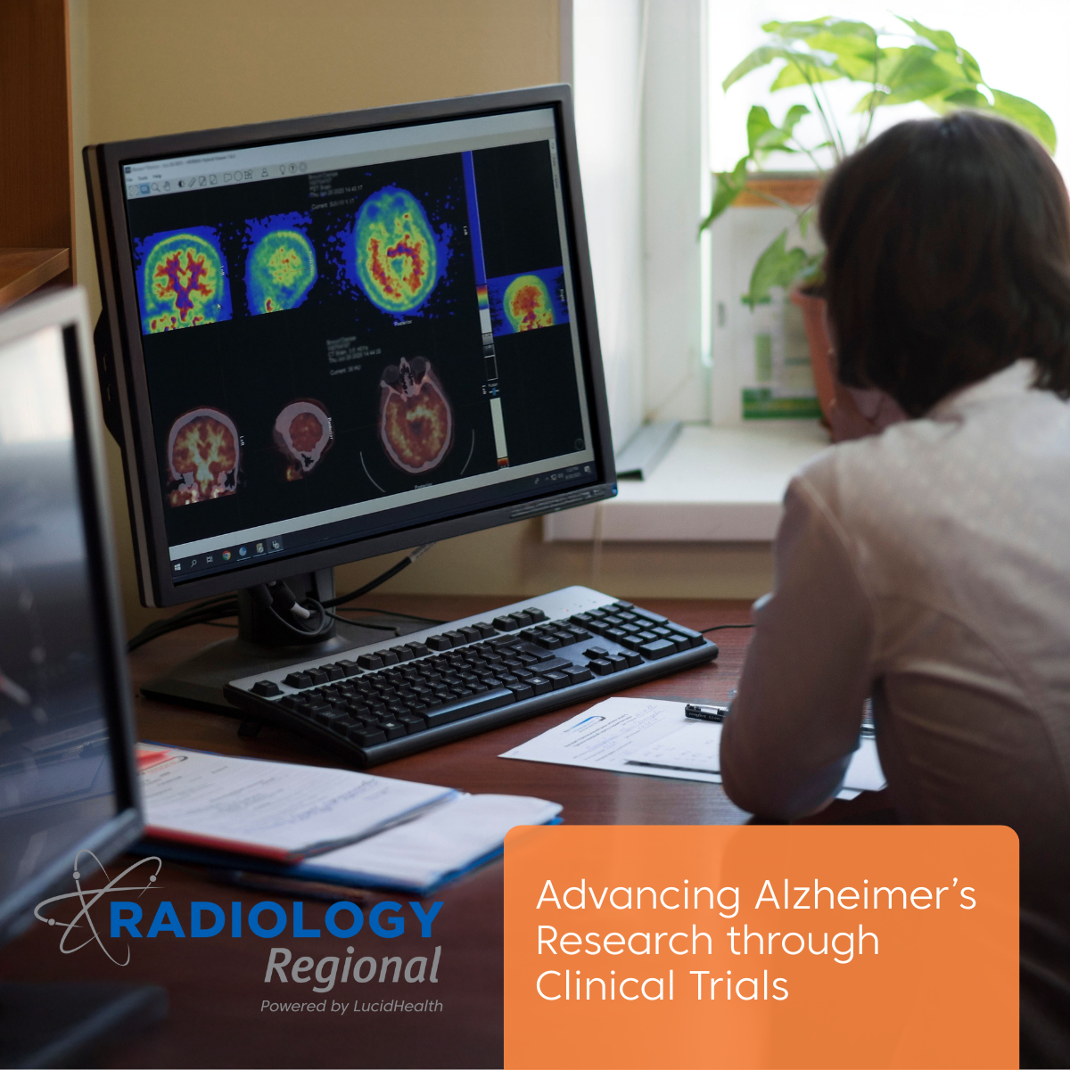 Alzheimer’s Research